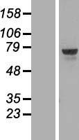 TOX1 (TOX) Human Over-expression Lysate