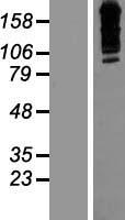 ZNF536 Human Over-expression Lysate