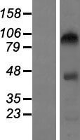 CEP104 Human Over-expression Lysate