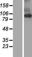 TMEM63A Human Over-expression Lysate