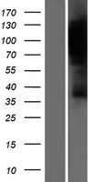 HURP (DLGAP5) Human Over-expression Lysate