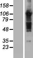 TBC1D5 Human Over-expression Lysate