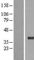 SERTAD2 Human Over-expression Lysate