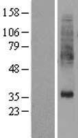 PTDSS1 Human Over-expression Lysate