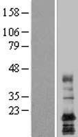 LAPTM4A Human Over-expression Lysate