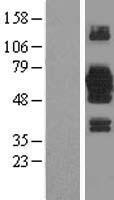 KIAA0494 (EFCAB14) Human Over-expression Lysate