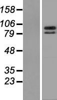 ZBTB39 Human Over-expression Lysate