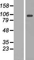 DNAJC6 Human Over-expression Lysate