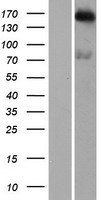DENND4B Human Over-expression Lysate