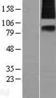 SV2A Human Over-expression Lysate