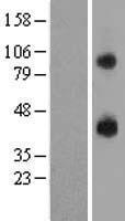 GPR105 (P2RY14) Human Over-expression Lysate