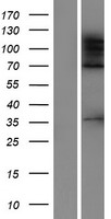 ADNP homeobox protein 2 (ADNP2) Human Over-expression Lysate