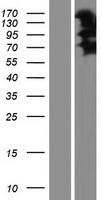 LIMCH1 Human Over-expression Lysate
