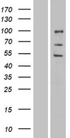 ENDOD1 Human Over-expression Lysate