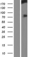 HECW1 Human Over-expression Lysate