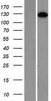 SMC5 Human Over-expression Lysate