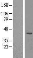 RRS1 Human Over-expression Lysate