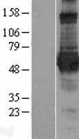 RNF156 (MGRN1) Human Over-expression Lysate