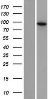 EXOC6B Human Over-expression Lysate