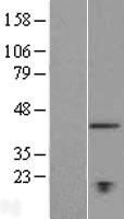 TMEM194A (NEMP1) Human Over-expression Lysate