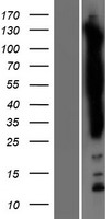 SASH1 Human Over-expression Lysate