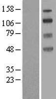 SLC9A8 Human Over-expression Lysate