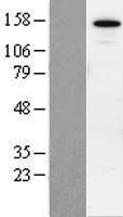 SIN3B Human Over-expression Lysate