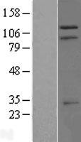TRIM37 Human Over-expression Lysate