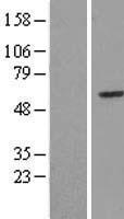 RRP8 Human Over-expression Lysate