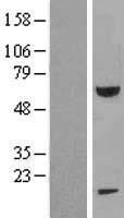 FEM 1B (FEM1B) Human Over-expression Lysate