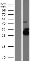 KCTD2 Human Over-expression Lysate
