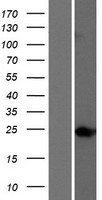 TTC9 Human Over-expression Lysate