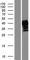 AMMECR1 Human Over-expression Lysate