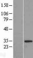HS747E2A (C22orf31) Human Over-expression Lysate