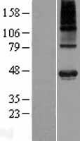WDR51A (POC1A) Human Over-expression Lysate