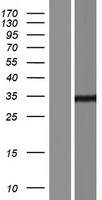 SPEF1 Human Over-expression Lysate