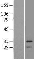 BRMS1 Human Over-expression Lysate