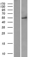 FAM149A Human Over-expression Lysate