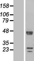 DPCD Human Over-expression Lysate
