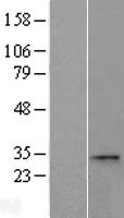 CCDC28A Human Over-expression Lysate