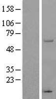 THUMPD3 Human Over-expression Lysate
