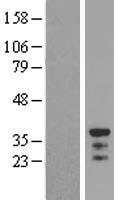 C18orf10 (TPGS2) Human Over-expression Lysate