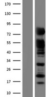 RAB11FIP5 Human Over-expression Lysate