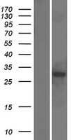 RWDD3 Human Over-expression Lysate