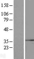 GCIP interacting protein p29 (SYF2) Human Over-expression Lysate