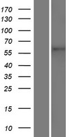 TMEM87A Human Over-expression Lysate
