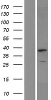 NGDN Human Over-expression Lysate