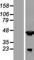 C20orf4 (AAR2) Human Over-expression Lysate