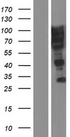 SUSD5 Human Over-expression Lysate