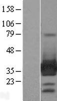 ARH (LDLRAP1) Human Over-expression Lysate